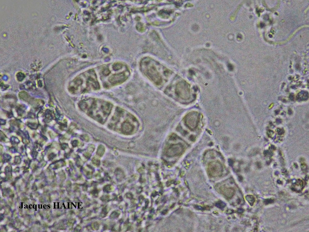 Collemopsidium ostrearum Taxon Atlantique-Manche forme sur Patella.